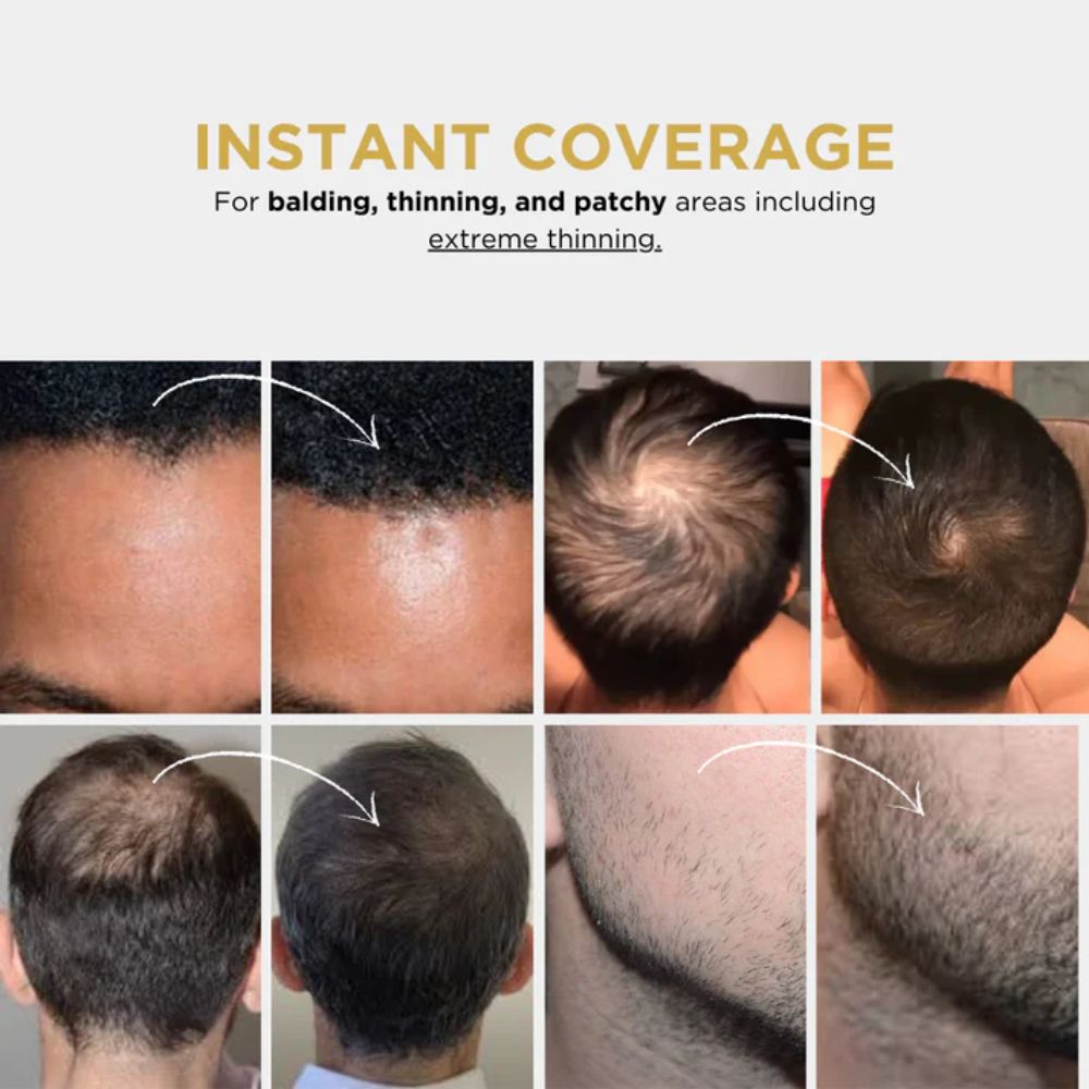HairEzy™ Hair Concealer