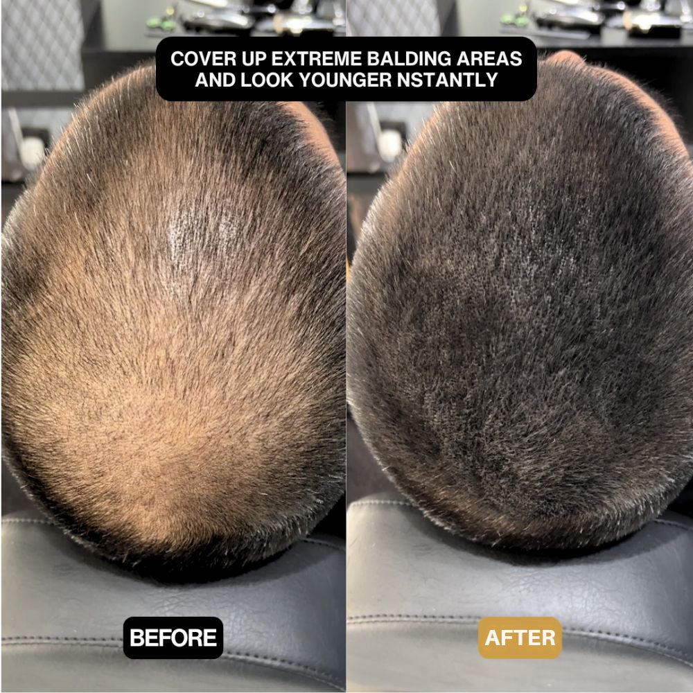 HairEzy™ Hair Concealer