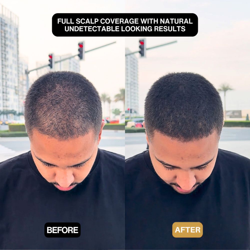HairEzy™ Hair Concealer